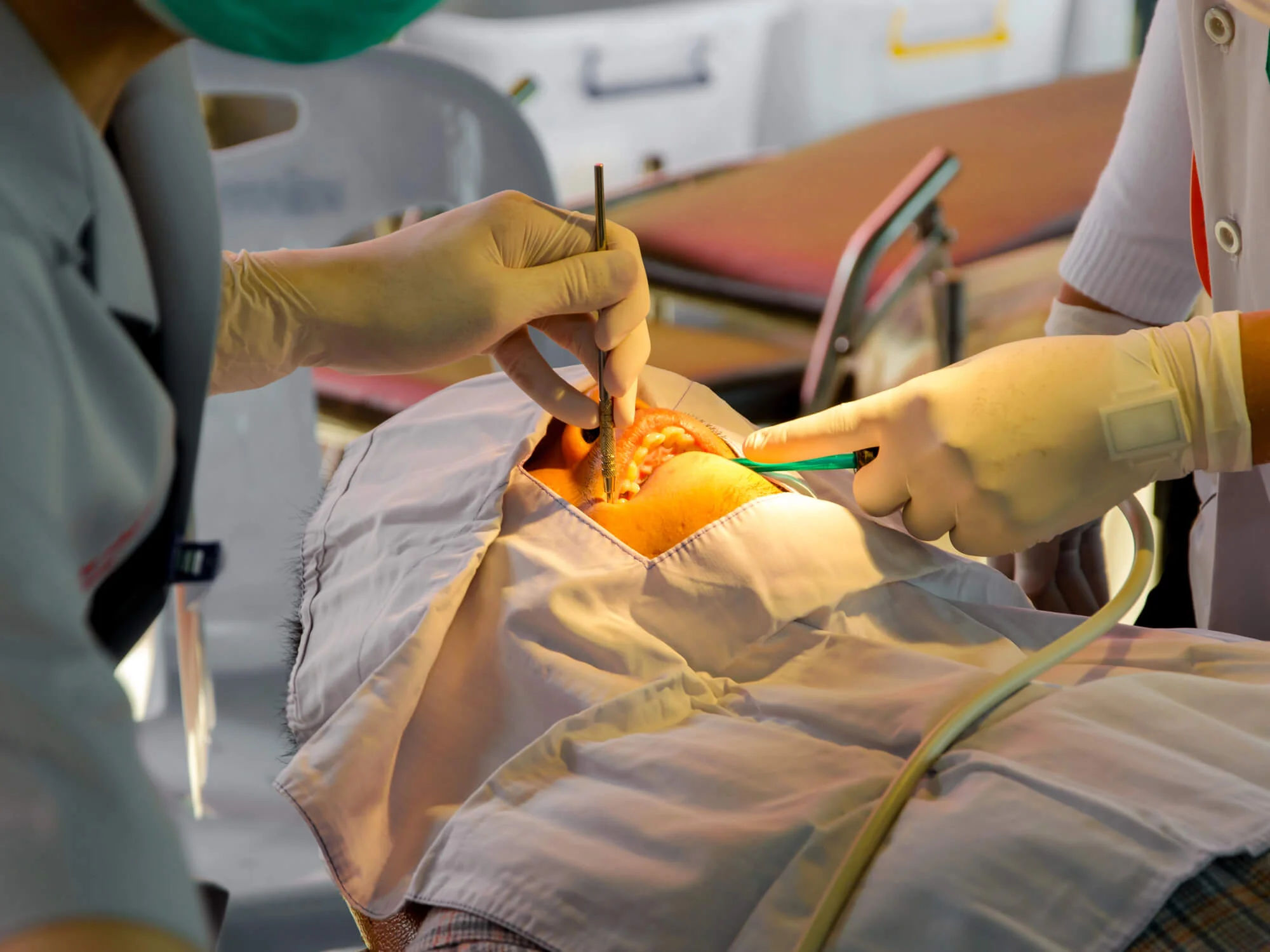 Oral-surgery-in-New-Smyrna-Beach-procedure-close-up