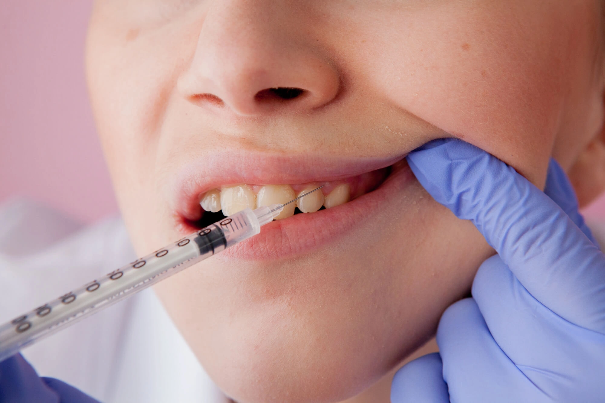 A Type of sedation dentistry new smyrna beach fl