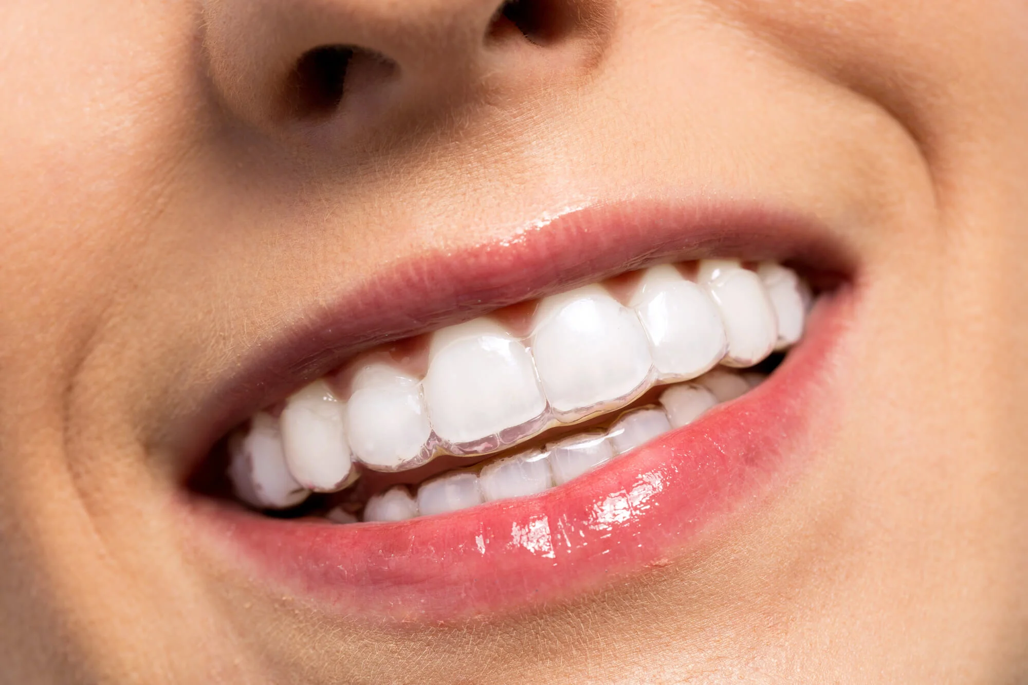 Healthy smile after family dentistry in New Smyrna Beach treatment