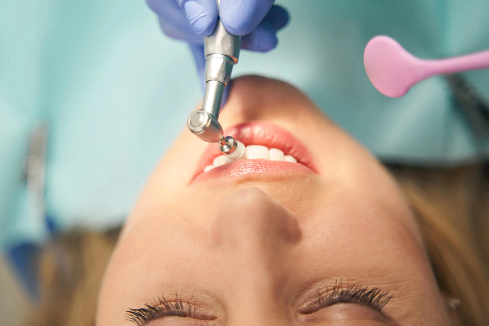 Dentist polishing patient teeth with tool New dentist in Rochelle