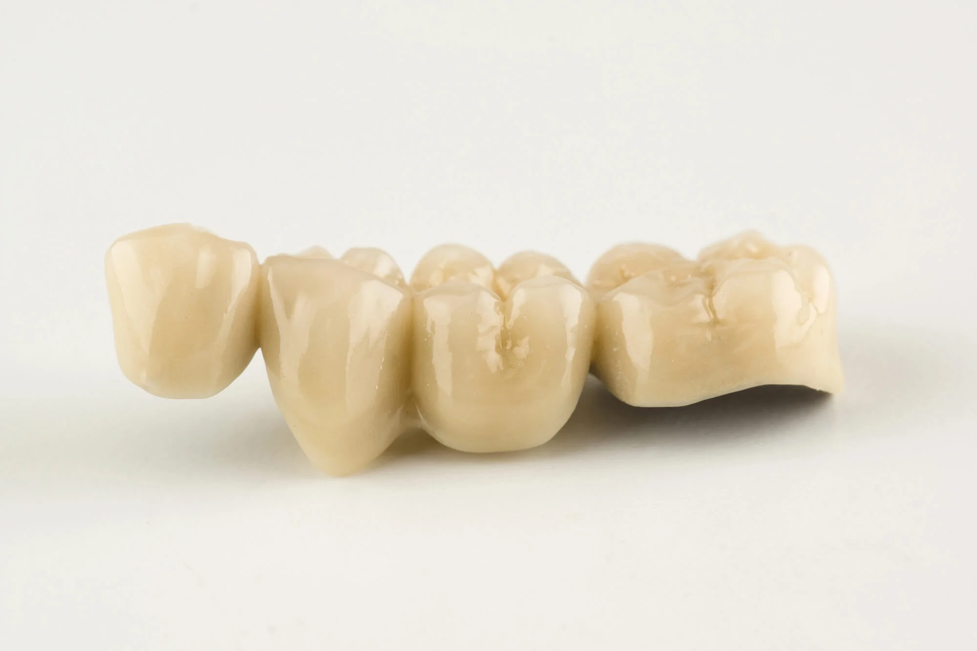 Dental restorations from a cosmetic dentist in Edgewater.